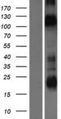 Western Blot: KCNH1 Overexpression Lysate [NBP2-09780]