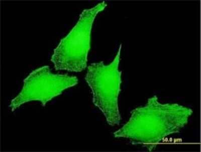 Immunocytochemistry/ Immunofluorescence: KCNIP4 Antibody (1A11) [H00080333-M01]