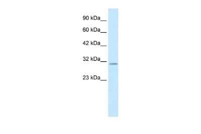 Western Blot: KCNIP4 Antibody [NBP2-84105]