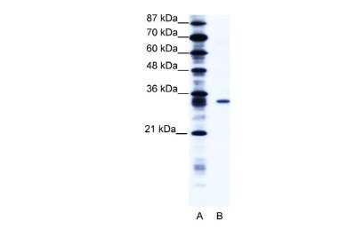 Western Blot: KCNIP4 Antibody [NBP2-84106]