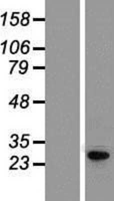 Western Blot: KCNIP4 Overexpression Lysate [NBP2-09918]