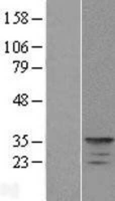 Western Blot: KCNIP4 Overexpression Lysate [NBP2-09990]