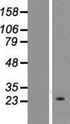 Western Blot: KCNIP4 Overexpression Lysate [NBP2-09991]