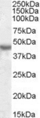 Western Blot: KCNJ1 Antibody [NBP1-36965]