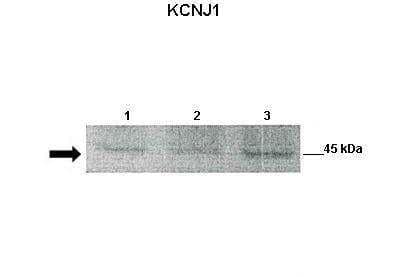 Western Blot: KCNJ1 Antibody [NBP2-87660]