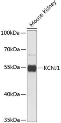 Western Blot: KCNJ1 AntibodyBSA Free [NBP3-04802]