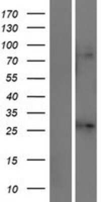 Western Blot: KCNJ1 Overexpression Lysate [NBL1-12162]