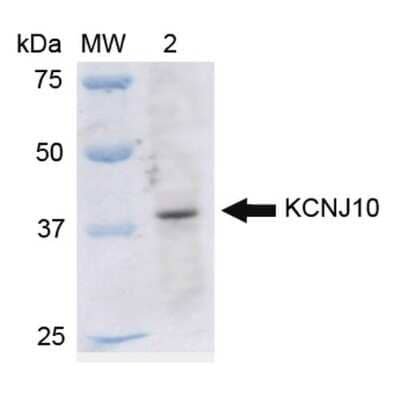 Western Blot: KCNJ10 Antibody [NBP3-18248]