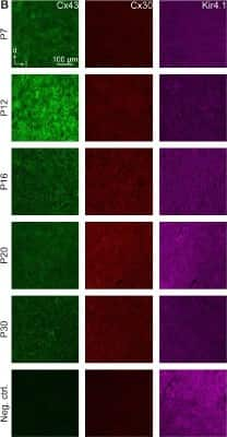 Immunohistochemistry: KCNJ10 Antibody (1C11) [H00003766-M01]