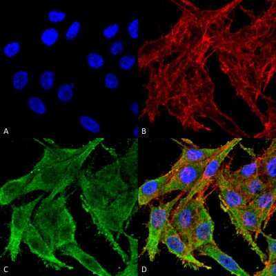 Immunocytochemistry/ Immunofluorescence: KCNJ10 Antibody [NBP3-18248]