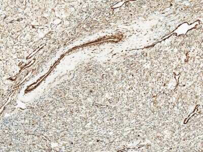 Immunohistochemistry: KCNJ10 Antibody [NBP3-18248]