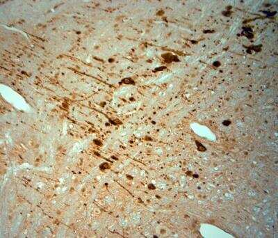 Immunohistochemistry-Paraffin: KCNJ10 Antibody [NBP1-20149]