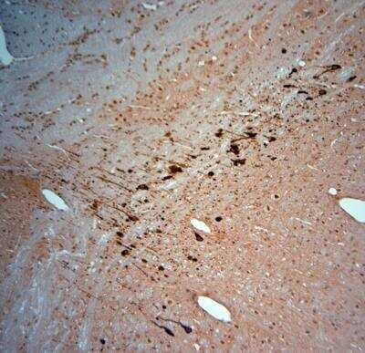 Immunohistochemistry-Paraffin: KCNJ10 Antibody [NBP1-20149]