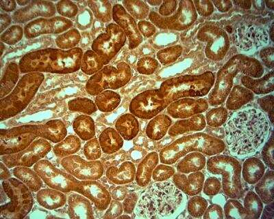 Immunohistochemistry-Paraffin: KCNJ10 Antibody [NBP1-20149]