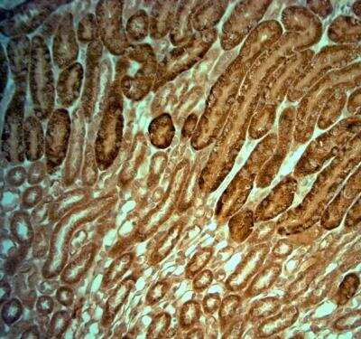 Immunohistochemistry-Paraffin: KCNJ10 Antibody [NBP1-20149]