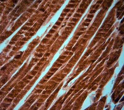 Immunohistochemistry-Paraffin: KCNJ10 Antibody [NBP1-20149]