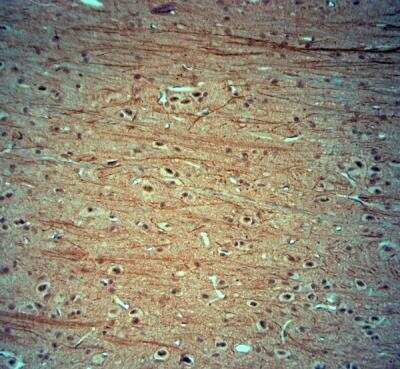 Immunohistochemistry-Paraffin: KCNJ10 Antibody [NBP1-20149]