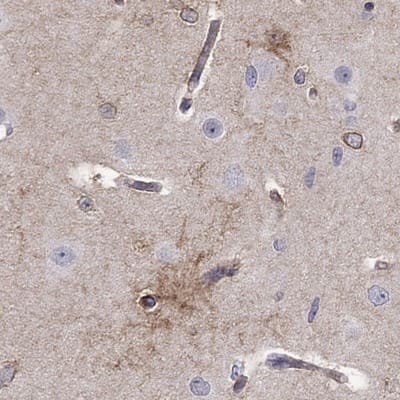 Immunohistochemistry-Paraffin: KCNJ10 Antibody [NBP2-62724]