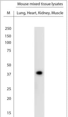 Western Blot: KCNJ10 Antibody [NBP1-20149]