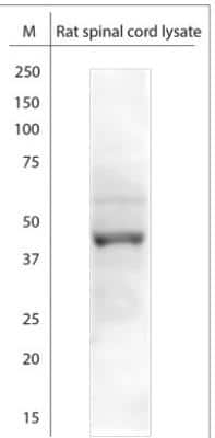 Western Blot: KCNJ10 Antibody [NBP1-70371]