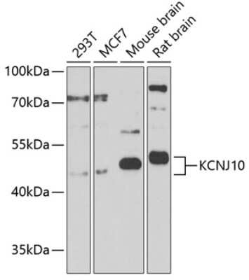 Western Blot: KCNJ10 AntibodyBSA Free [NBP3-03960]