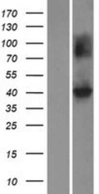 Western Blot: KCNJ10 Overexpression Lysate [NBP2-08133]