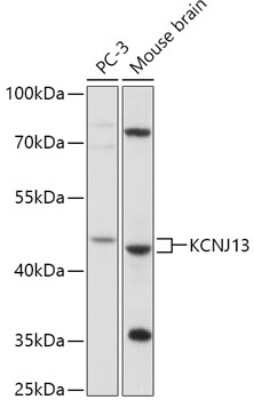 Western Blot: KCNJ13 AntibodyAzide and BSA Free [NBP3-04750]