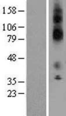 Western Blot: KCNJ13 Overexpression Lysate [NBL1-12165]