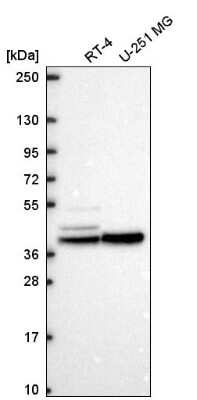 Western Blot: KCNJ14 Antibody [NBP2-57775]