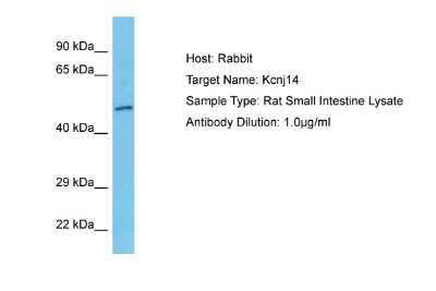 Western Blot: KCNJ14 Antibody [NBP2-83104]