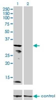 Western Blot: KCNJ15 Antibody (1B2) [H00003772-M01]