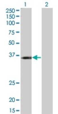 Western Blot: KCNJ15 Antibody (1B2) [H00003772-M01]