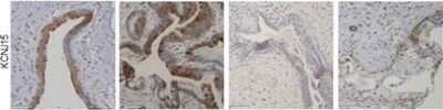 Immunohistochemistry: KCNJ15 Antibody [NBP1-83091]