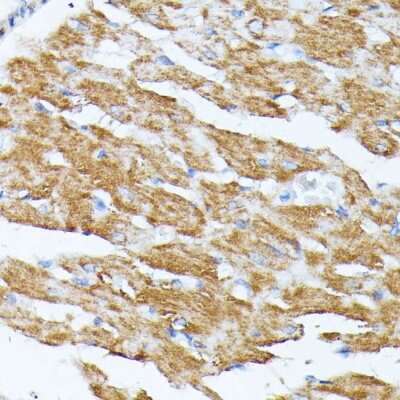 Immunohistochemistry-Paraffin: KCNJ15 Antibody - Azide and BSA Free [NBP3-04863]