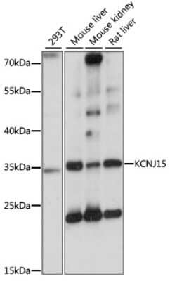 Western Blot: KCNJ15 AntibodyAzide and BSA Free [NBP3-04863]