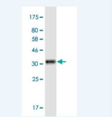 Western Blot: KCNK1 Antibody (4D7) [H00003775-M01-100ug]