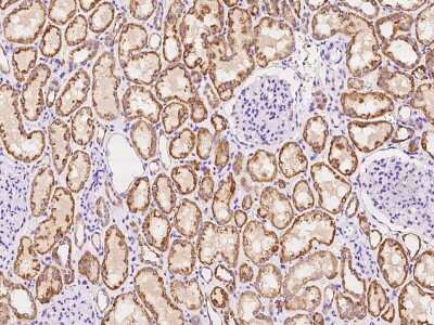 Immunohistochemistry-Paraffin: KCNK1 Antibody [NBP2-97436]