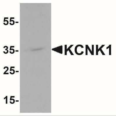 Western Blot: KCNK1 AntibodyBSA Free [NBP2-41301]