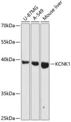 Western Blot: KCNK1 AntibodyAzide and BSA Free [NBP3-04907]