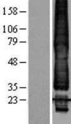 Western Blot: KCNK1 Overexpression Lysate [NBL1-12176]