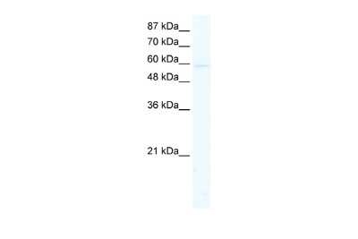 Western Blot: KCNK10 Antibody [NBP2-87662]