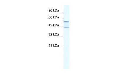 Western Blot: KCNK10 Antibody [NBP2-87665]