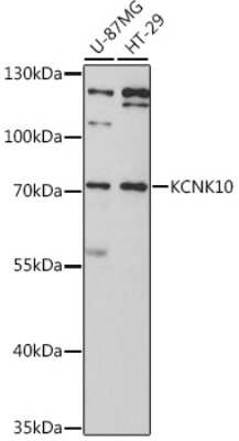 Western Blot: KCNK10 AntibodyAzide and BSA Free [NBP3-05006]