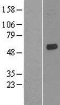 Western Blot: KCNK10 Overexpression Lysate [NBL1-12177]