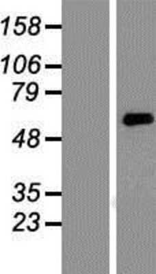 Western Blot: KCNK10 Overexpression Lysate [NBP2-09897]