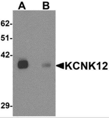 Western Blot: KCNK12 AntibodyBSA Free [NBP2-81727]