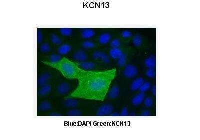 Immunohistochemistry: KCNK13 Antibody [NBP2-86690]