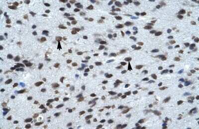 Immunohistochemistry-Paraffin: KCNK13 Antibody [NBP2-86690]