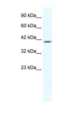 Western Blot: KCNK13 Antibody [NBP1-80083]