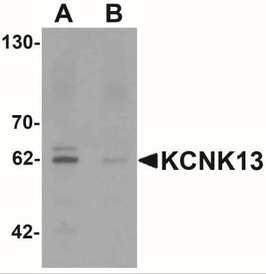 Western Blot: KCNK13 AntibodyBSA Free [NBP2-41132]